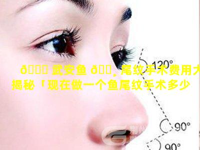 💐 武安鱼 🕸 尾纹手术费用大揭秘「现在做一个鱼尾纹手术多少钱」